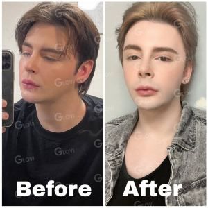 Clinic — Glovi Plastic Surgery