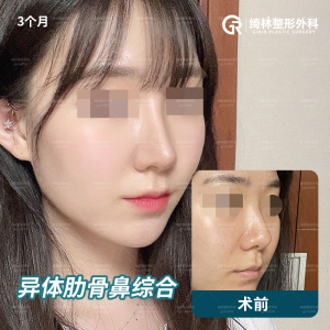 GIRIN Plastic Surgery