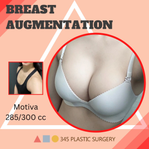 After — 345 PLASTIC SURGERY