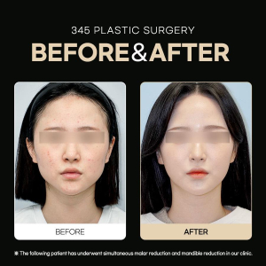After — 345 PLASTIC SURGERY