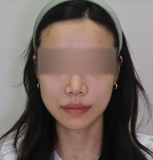 After — Ado Clinic