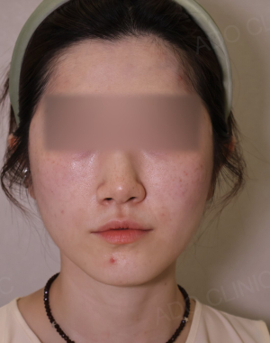 After — Ado Clinic