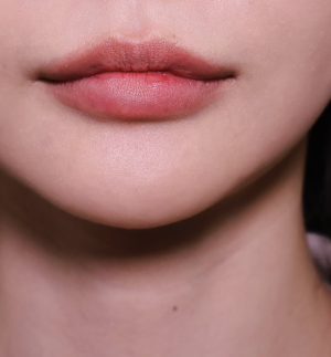 Before — Ado Clinic