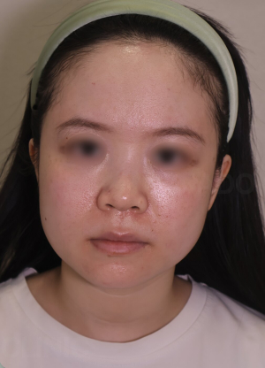 Before — Ado Clinic