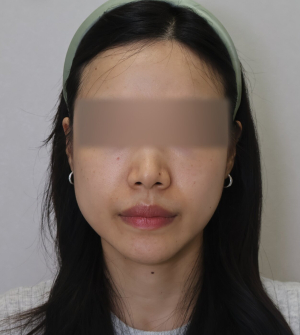 Before — Ado Clinic
