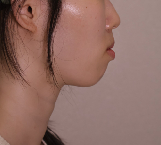 Before — Ado Clinic