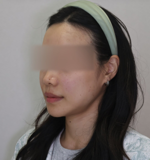 After — Ado Clinic