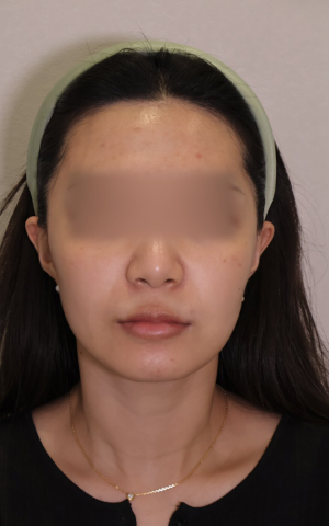 Before — Ado Clinic