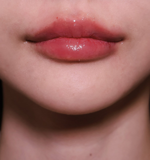 After — Ado Clinic