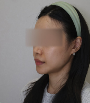 Before — Ado Clinic