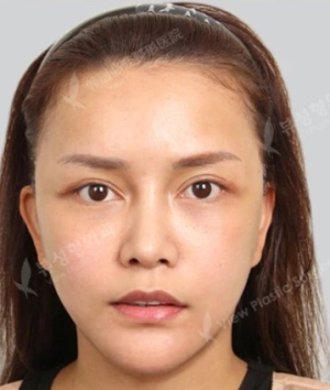 After — โรงพยาบาลศัลยกรรม วิว