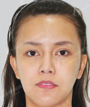 Before — โรงพยาบาลศัลยกรรม วิว