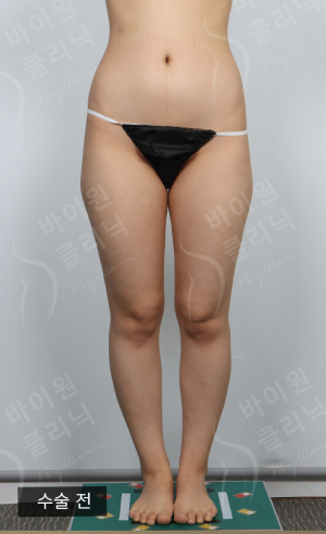 Before — BYWON Clinic