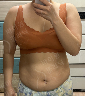 Before — BYWON Clinic