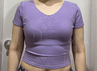 Before — BYWON Clinic