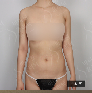 After — BYWON Clinic