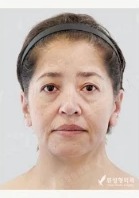View Plastic Surgery — Korea cost, reviews & before-after | MISOODA