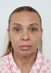 View Plastic Surgery — Korea cost, reviews & before-after | MISOODA