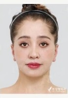 View Plastic Surgery — Korea cost, reviews & before-after | MISOODA